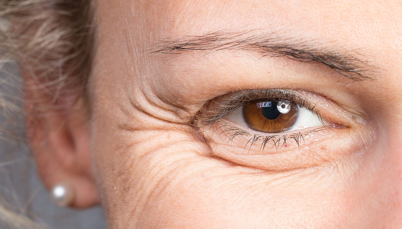 Crows Feet Sunscreen