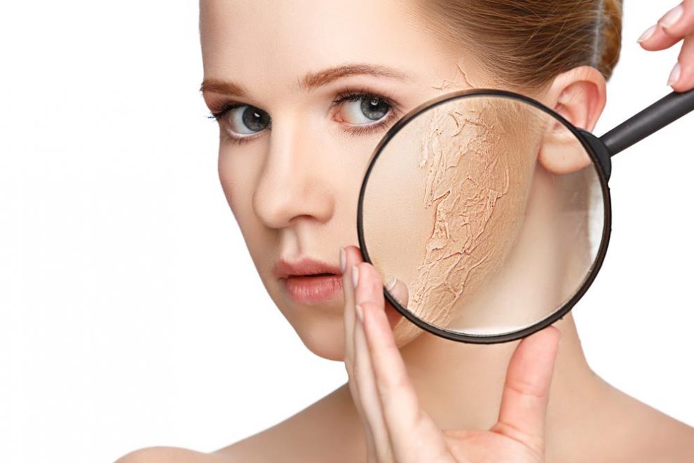 Dry Skin
