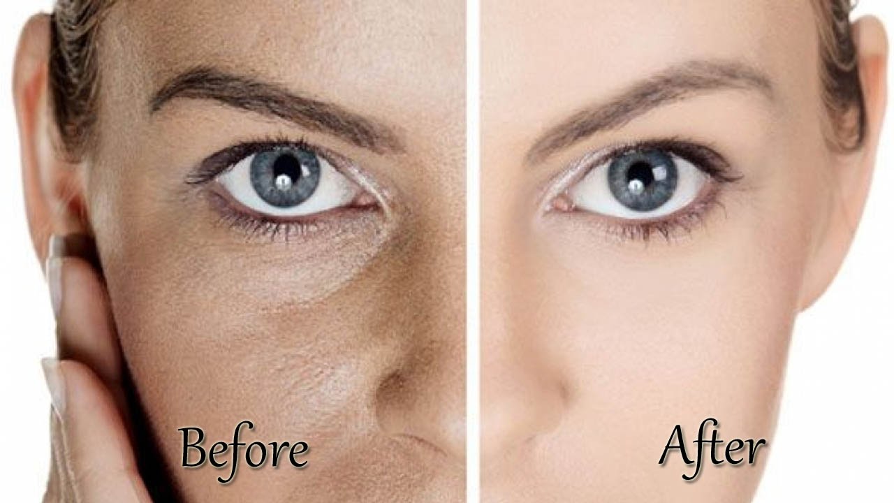 Skin Pores 