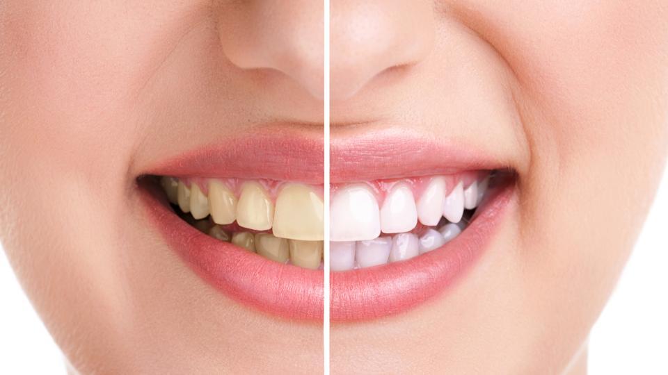 Neglecting Teeth Look Older